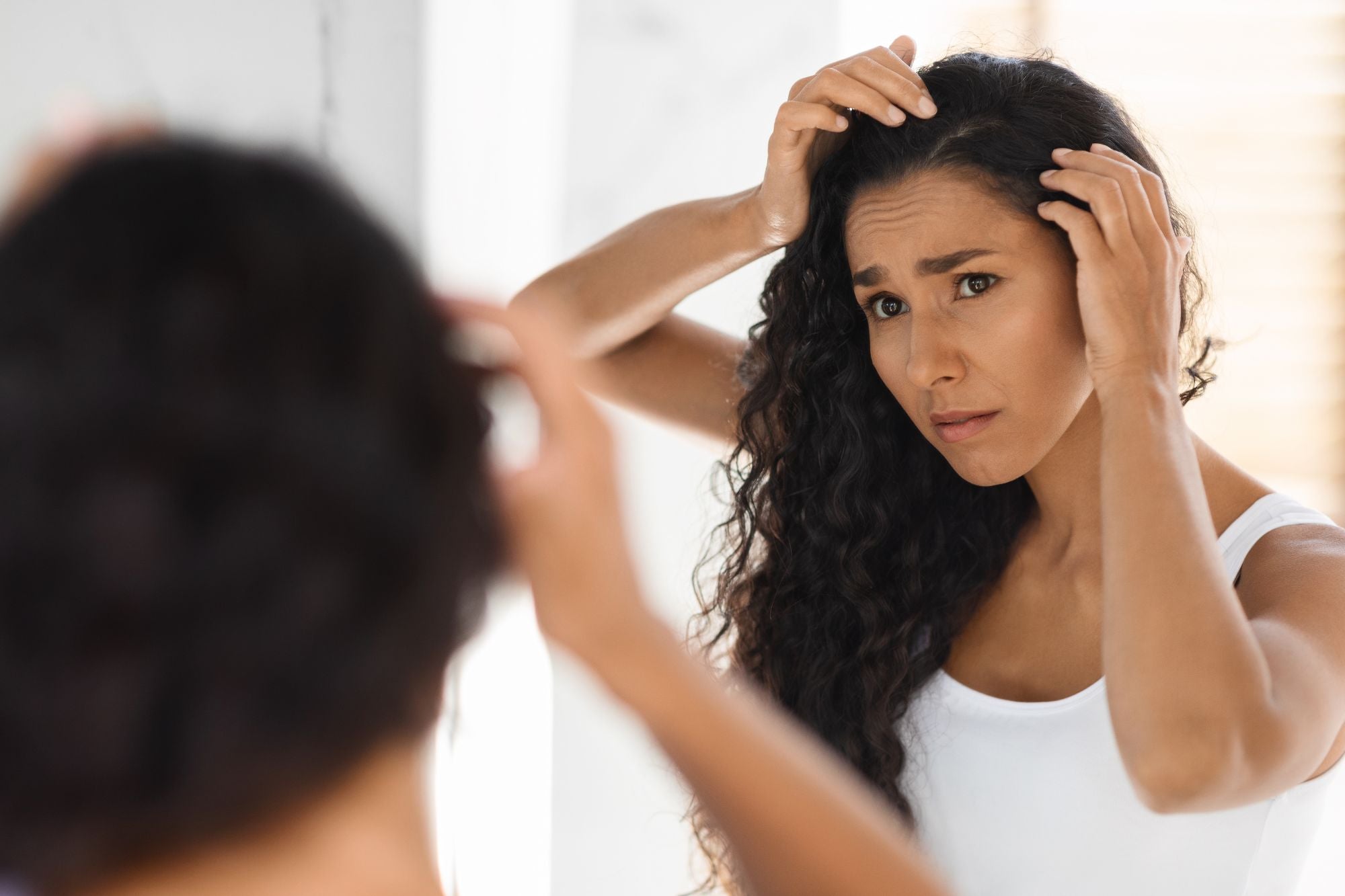 Dealing With Dandruff